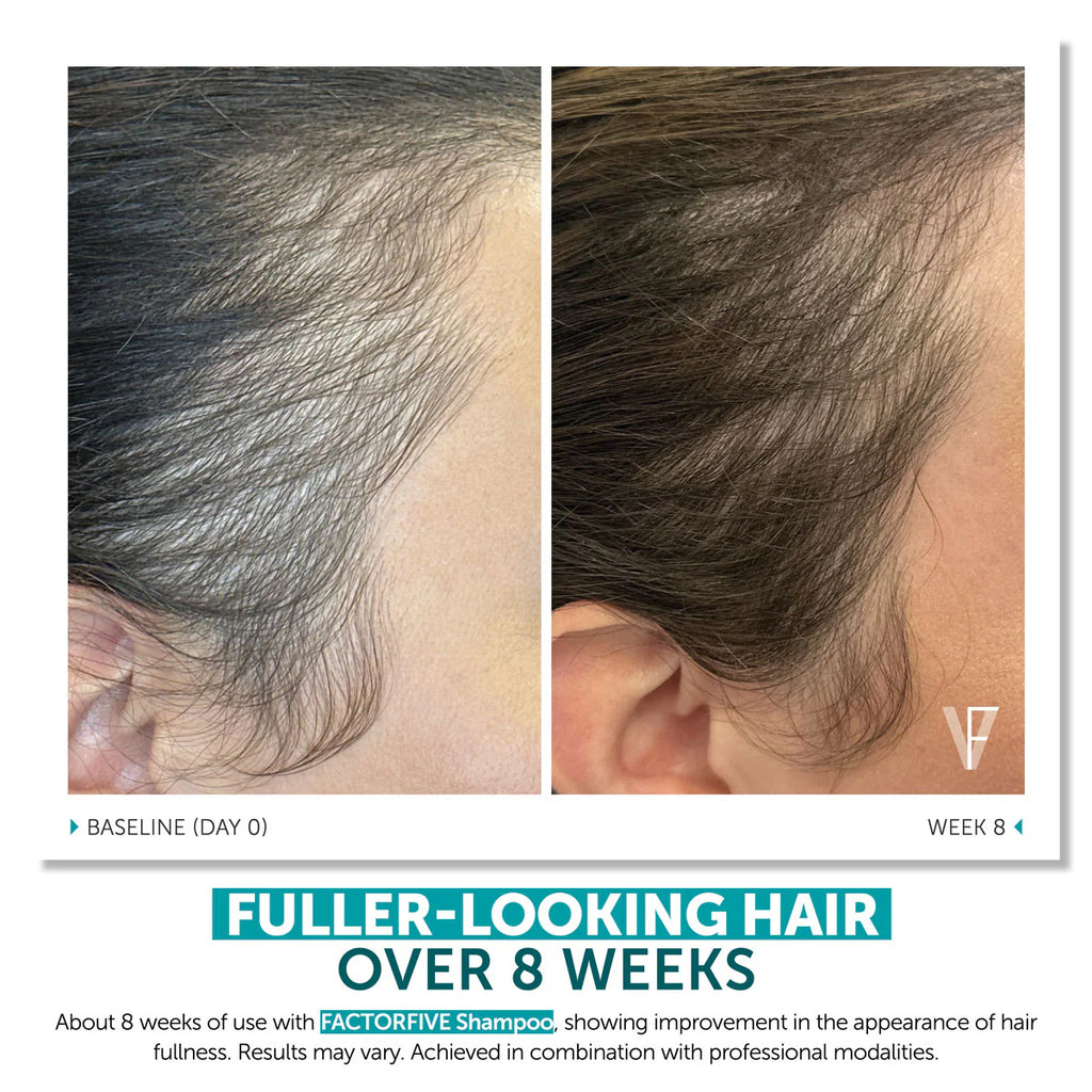 FACTORFIVE SHAMPOO ADVANCED HAIRCARE
