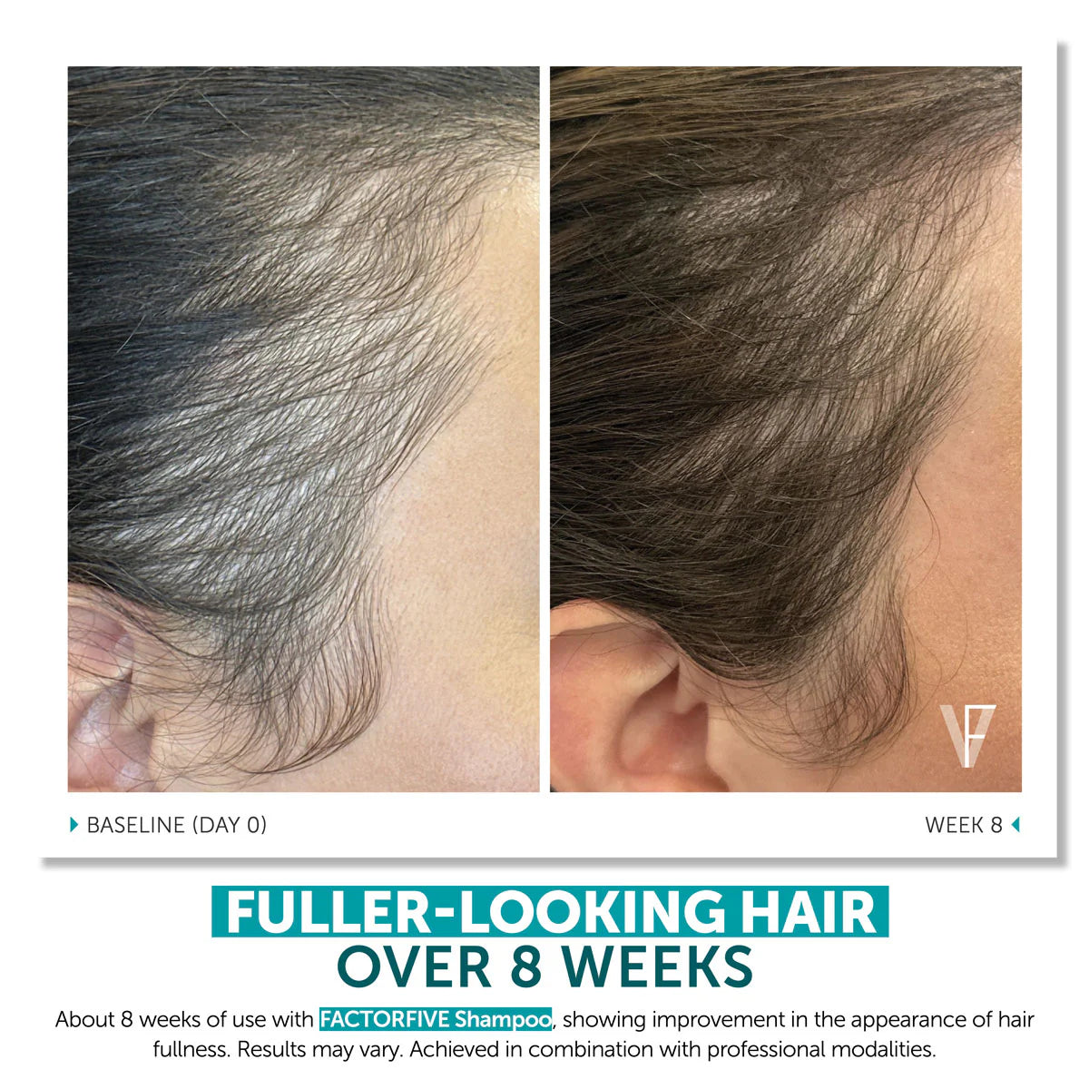 FACTORFIVE SHAMPOO ADVANCED HAIRCARE